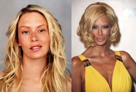 Jenna Jameson plastic surgery for adult movie star