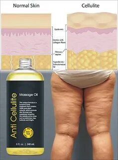 100% Pure Plants Extracts Body Massage Oil Anti Cellulite Pr