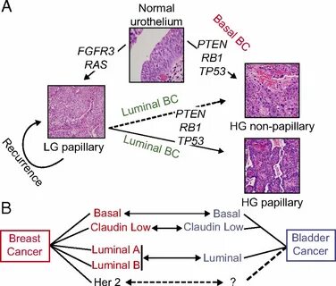 pêche estomac parfum basal vs luminal breast cancer spectaculaire Brise Meyella