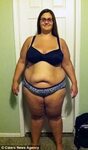Obese Michigan woman loses 151lbs thanks to gastric band Dai