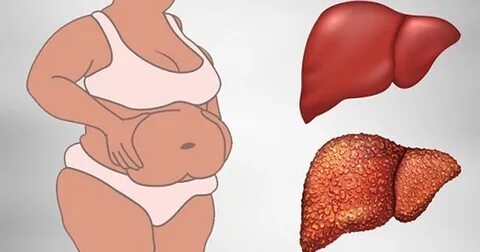 12 Signs to Watch out for Liver Damage - READit