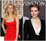 All about The Scarlett Johansson breast reduction - Plastic 