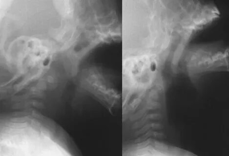 X ray deep throat image. xxx tube 3gp.