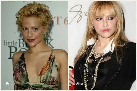 Celebrity Plastic Surgery Nightmares - DailyBuzzer.net