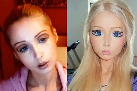 AJh,valeria lukyanova before and after surgery,hrdsindia.org