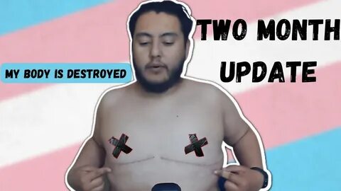 Surgery Update (2 months later) MtFtM - YouTube