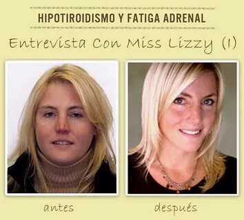 Entrevista: Miss Lizzy, Recuperada de Hipotiroidismo y Fatig