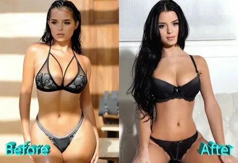 Demi Mawby Before and After Cosmetic Surgery Demi mawby, Cel