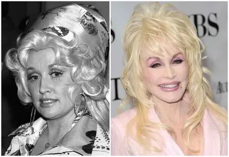 DOLLY PARTON - HELLO, I’M DOLLY Without makeup, Celebrity lo
