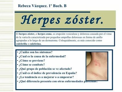HERPES ZOSTER