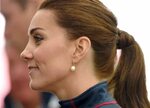 Kate Middleton Has a Massive Scar on Her Face and the Story 