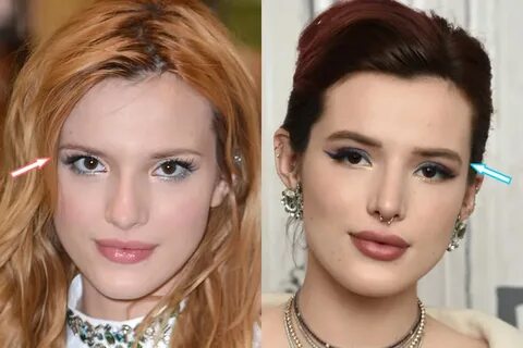 Did Bella Thorne Get Plastic Surgery? (Before & After 2022)