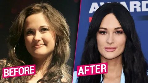 Did Kacey Musgraves Undergo Plastic Surgery Including Boob J