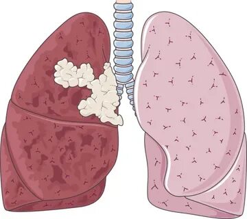 Lungs clipart transparent background, Lungs transparent back