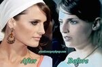 Stana Katic Nose Job Plastic Surgery Before and After Pictur
