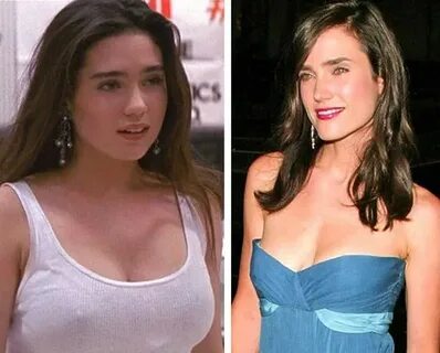 Jennifer Connelly Breast Surgery