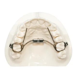 Mini-RPE - Five Star Orthodontic