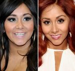 Pin on Celebrity Plastic Surgery Before and After Photos