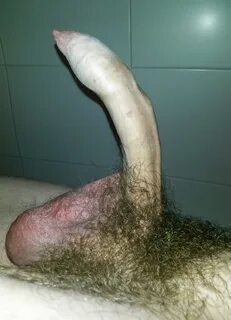 Ugly penis pictures