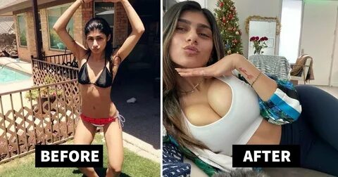 Mia Khalifa Before Surgery Incident of 'Exploded' Breast Imp