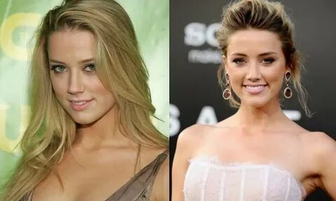 Amber Heard before and after plastic surgery (35) Celebrity 