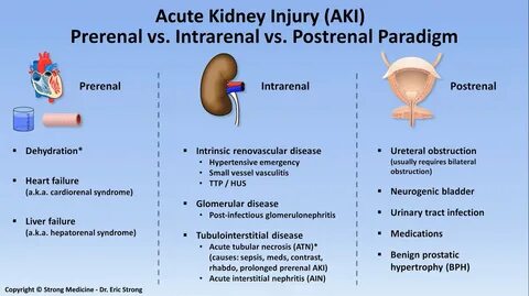 Acute Kidney Injury - Classification Prerenal: * Dehydration