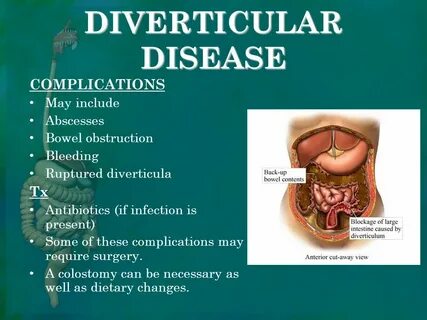 DIGESTIVE DISEASES ppt video online download