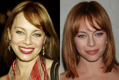 Melinda Clarke Plastic Surgery Before and After Celebie