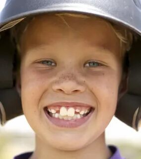 Buck Teeth In Kids: Causes, Health Risks, Pictures & More