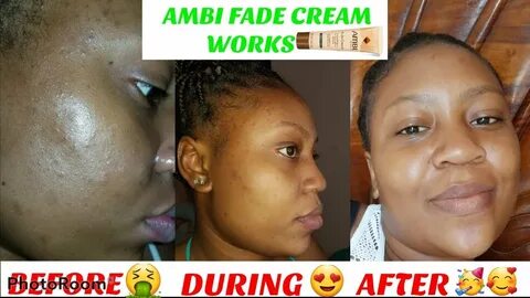 HOW TO: FADE DARK SPOTS USING AMBI FADE CREAM 🤩 PICTURES INC