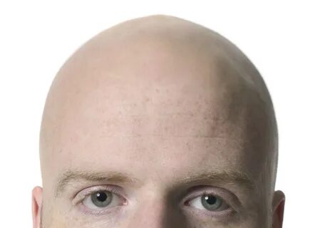 How to Regrow Hair Naturally in Bald Area Hair Transplant Du