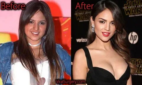 Eiza Gonzalez Plastic Surgery, Before and After Nose Job Pic