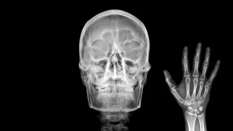 X Ray Asian Skull (Thai People) - Сток картинки - iStock