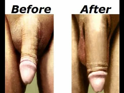 Penis Enlargement Natural Techniques hotelstankoff.com