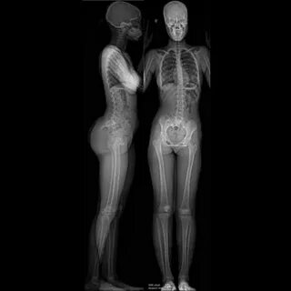 Women nude in x rays " Naked Wife Fucking Pics