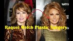 Raquel Welch Plastic Surgery Before and After - YouTube