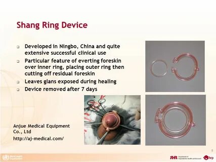 Adult Male Circumcision Devices - ppt download