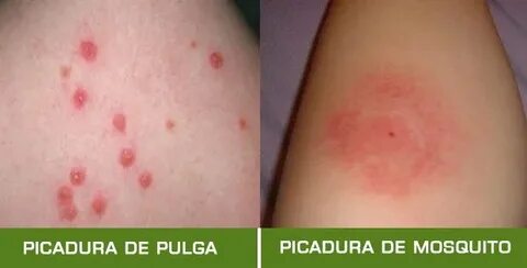 Picadura de pulga en humanos: cómo identificar, síntomas, ri