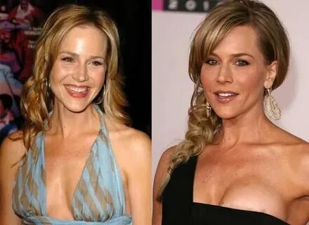 Julie Benz Plastic Surgery Photo Before and After - http://w