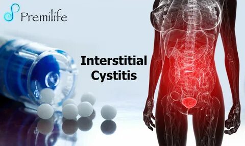Interstitial Cystitis Premilife - Homeopathic Remedies