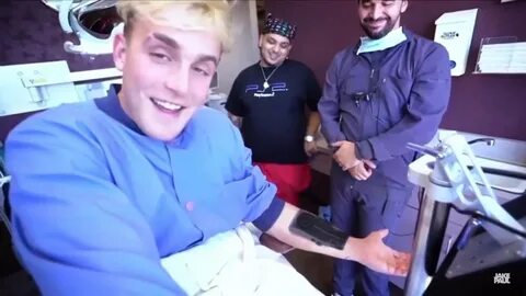 Jake Paul fakes getting an camera implanted into his arms (f