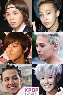 #gd #gdragon #bigbang #kpop K-POP Plastic surgery ВКонтакте