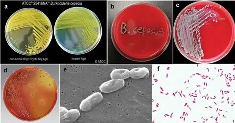 Biochemical Test of Burkholderia cepacia