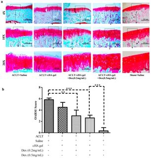 IJMS Free Full-Text Intra-Articular Injection of Cross-Linke