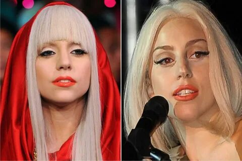 Lady Gaga Nose Job Plastic Surgery - Bra Size Measurements