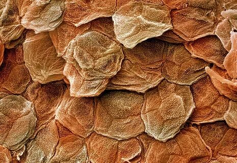 Human Skin Sem Photograph by Power And Syred Pixels