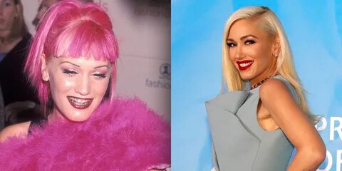 Gwen Stefani reflects on her pink hair and braces (and other