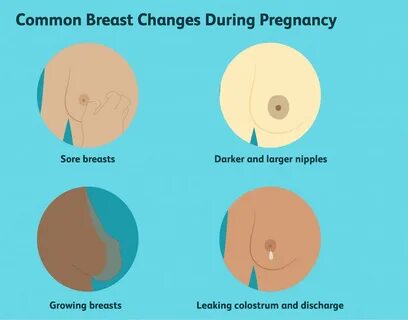 How long are boobs sore in pregnancy