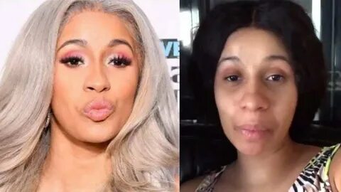 Cardi B Shocking Transformation Got FACE LIFT Now Looks 'Unr