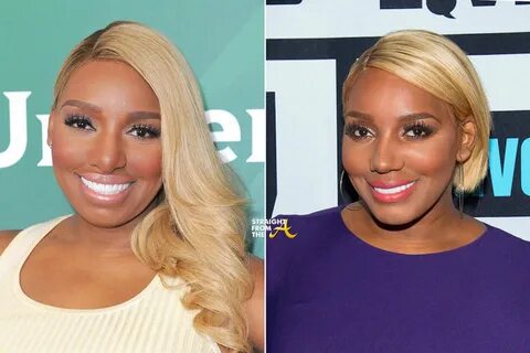 Nene New Nose Before and After 2 - Straight From The A SFTA 